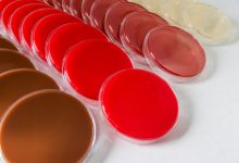 محیط کشت چیست و چه کاربردی دارد؟