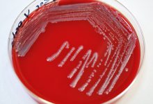بلاد آگار یا آگار خون دار چیست؟ - اجزا وکاربرد های آن