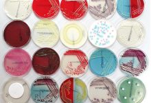 محیط کشت و انواع آن در یگ نگاه کوتاه و اجمالی