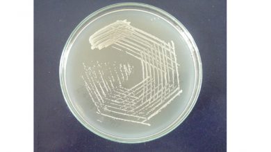 میلک آگار چیست؟ - کاربرد و ساخت آن