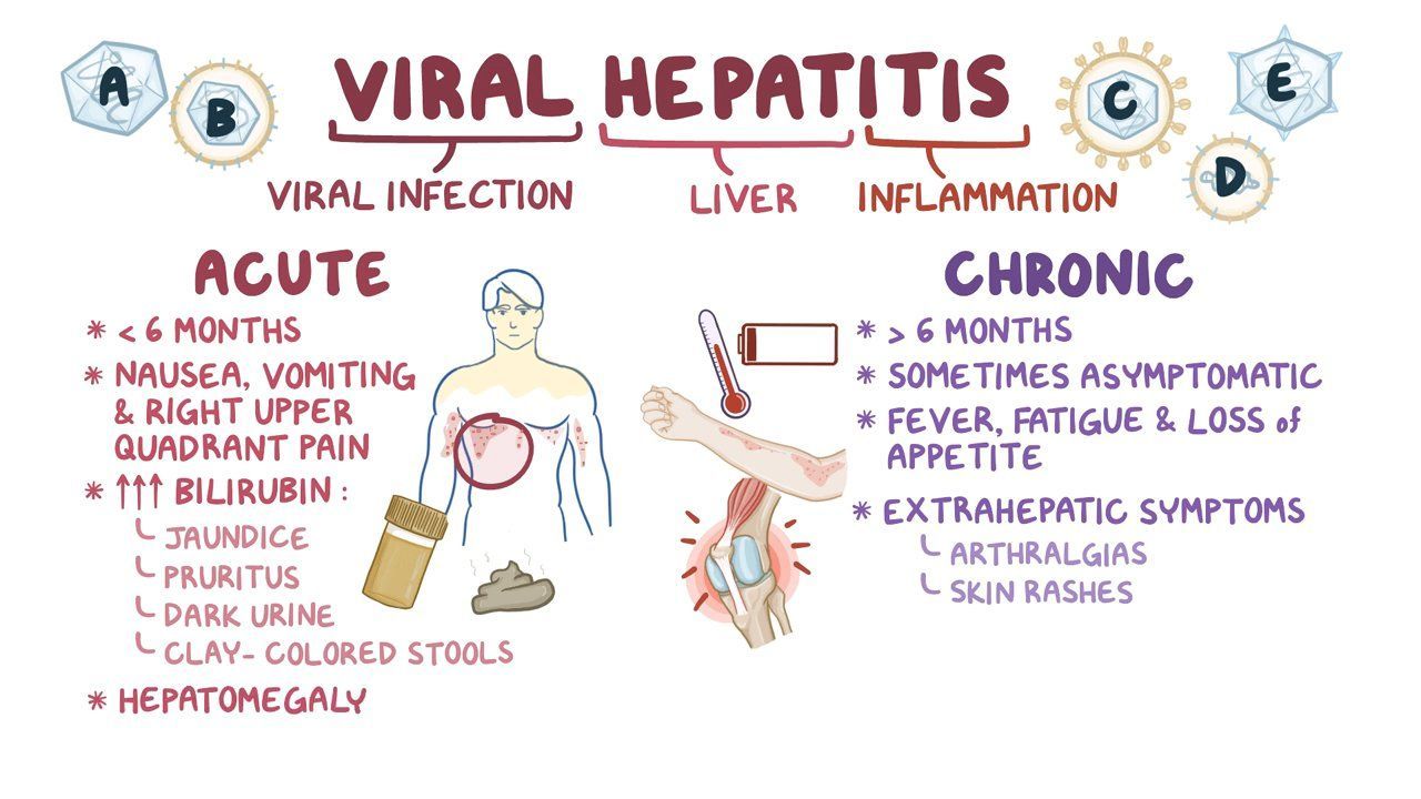 Viral kak. Hepatitis treatment. Clinical Symptoms of Viral Hepatitis. KTHY Viral.