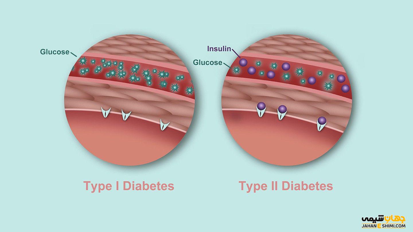 دیابت نوع 2 چیست و چطور می توان از آن پیشگیری کرد؟