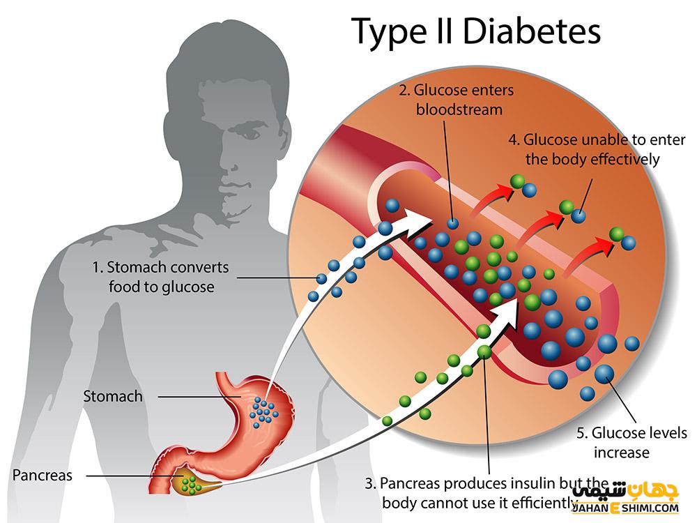 دیابت نوع 2 چیست و چطور می توان از آن پیشگیری کرد؟