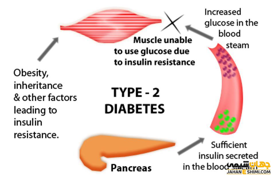 دیابت نوع 2 چیست و چطور می توان از آن پیشگیری کرد؟