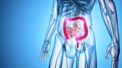 سرطان روده بزرگ چیست و چه افرادی به آن مبتلا می شوند؟