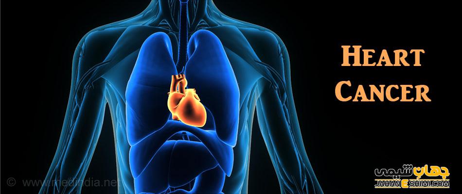 سرطان قلب چیست و آیا می توان از آن پیشگیری کرد؟