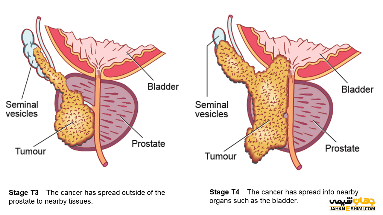 What is the size of a normal prostate cm
