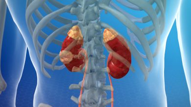 سرطان کلیه چیست و چه علائم هشدار دهنده ای دارد؟