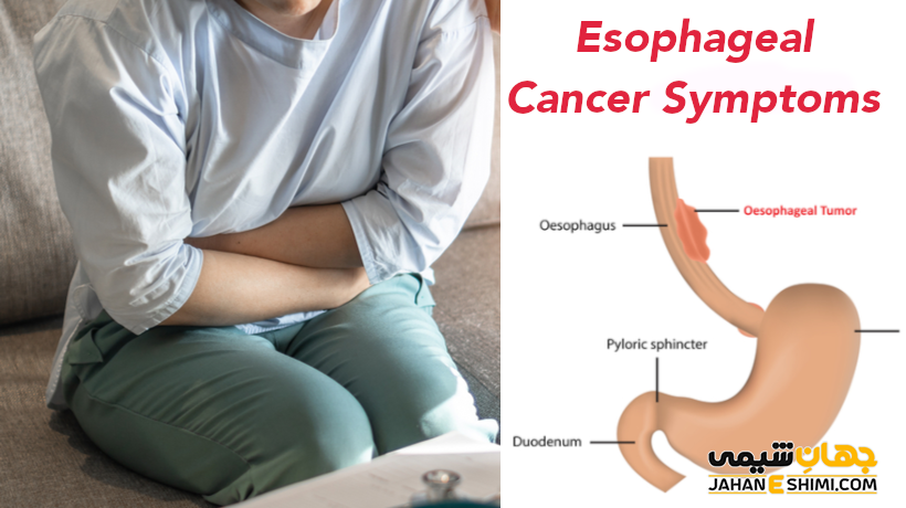 علائم و عوارض سرطان مری چیست و آیا قابل پیشگیری است؟