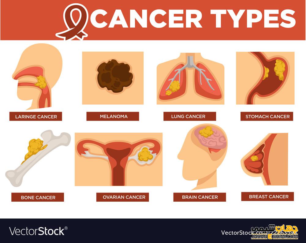 آشنایی با انواع سرطان در انسان و علائم آنها