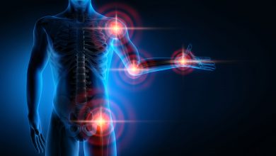 بیماری آرتروز چیست و از علائم آزاردهنده آن چه می دانید؟