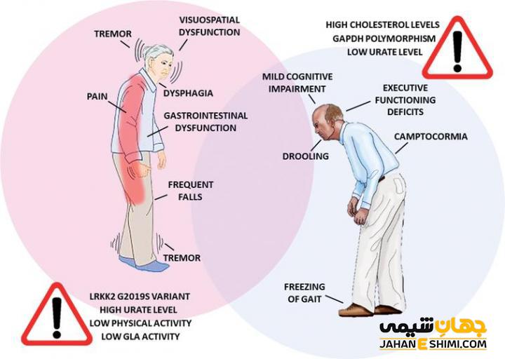 بیماری پارکینسون چیست و چگونه می توان از آن پیشگیری کرد؟