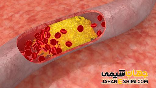 تصلب شرایین یا آترواسکلروز چیست و چه عواقبی دارد؟
