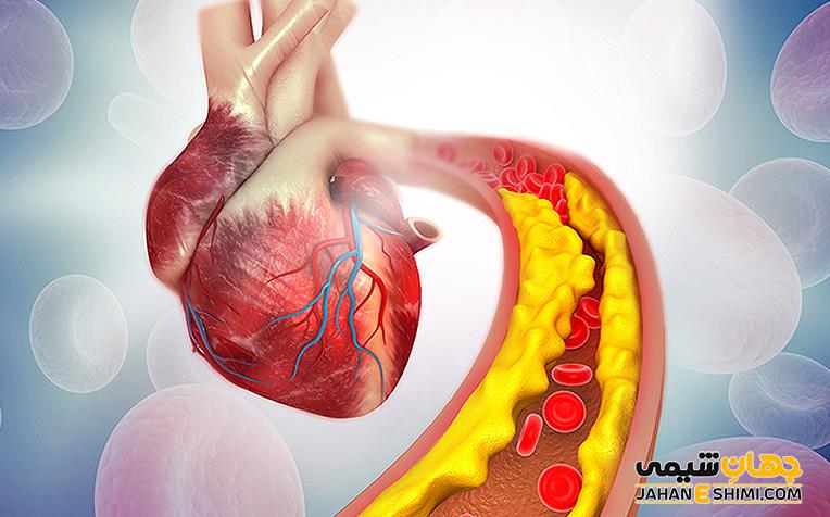 تصلب شرایین یا آترواسکلروز چیست و چه عواقبی دارد؟