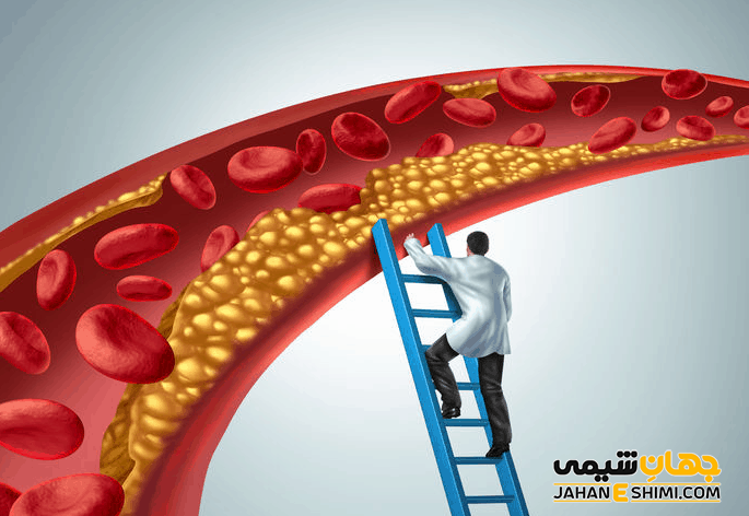 تصلب شرایین یا آترواسکلروز چیست و چه عواقبی دارد؟