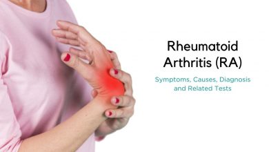 روماتیسم یا آرتریت روماتوئید چیست و چه علائمی دارد؟