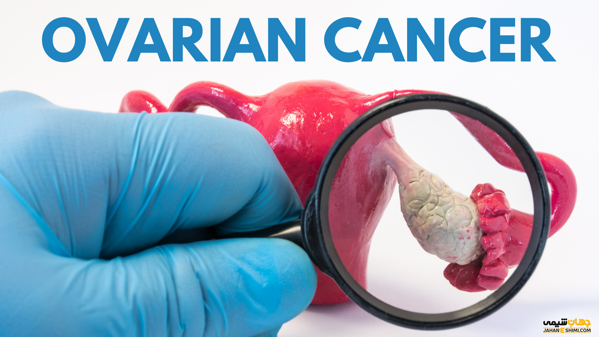 سرطان تخمدان چیست و از علائم و عوارض آن چه می دانید؟