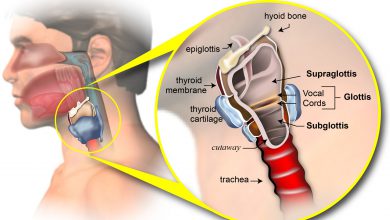 سرطان حنجره چیست و چه نشانه هایی دارد؟