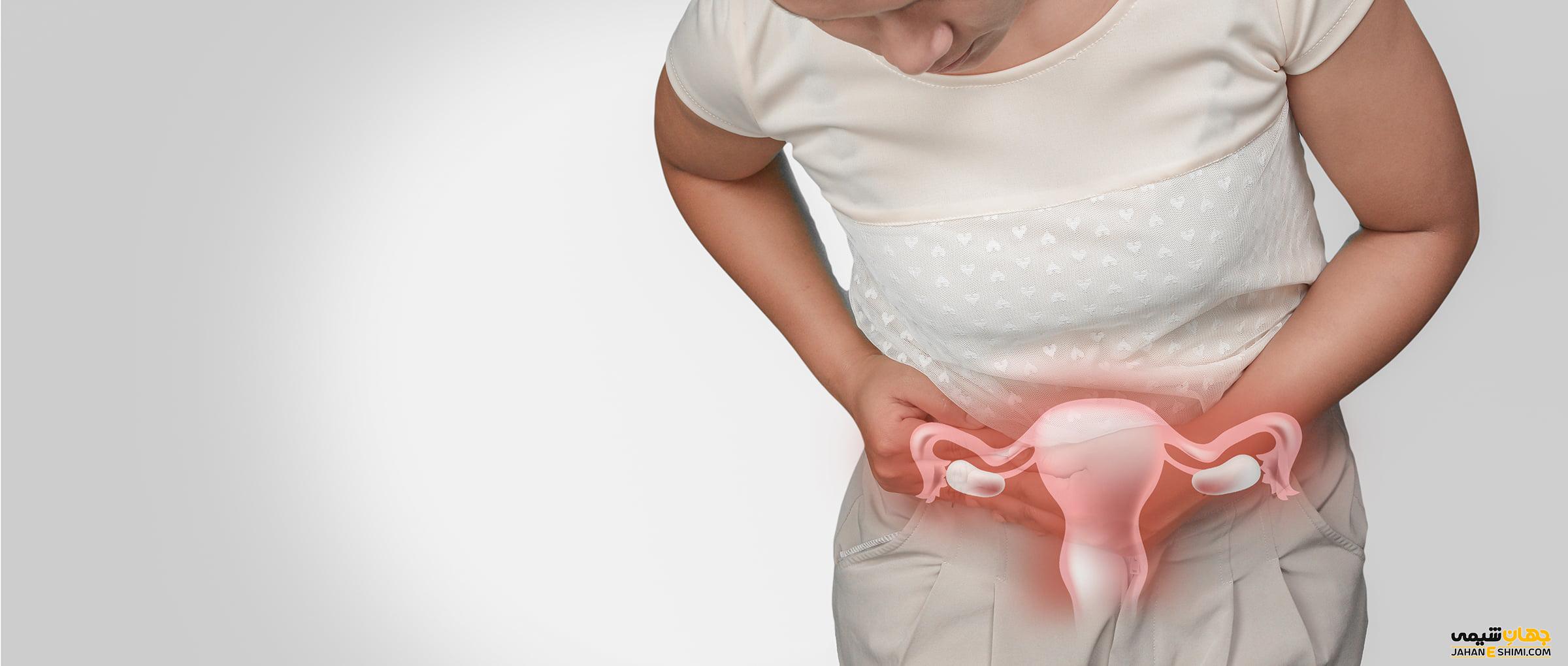 سرطان رحم چیست و چرا به آن مبتلا می شویم؟