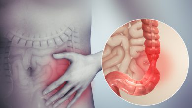 سندرم روده تحریک پذیر چیست و چه علائمی دارد؟