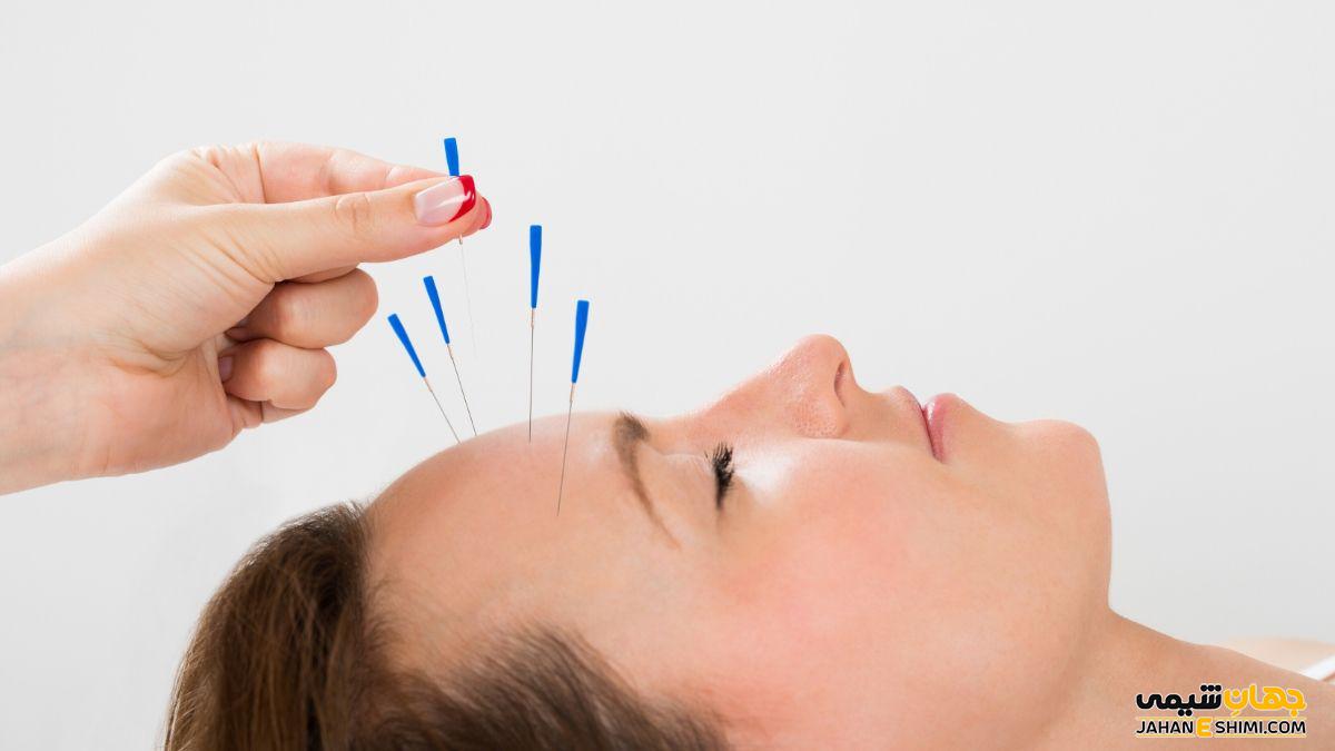 طب سوزنی چیست و از اثرات درمانی آن چه می دانید؟