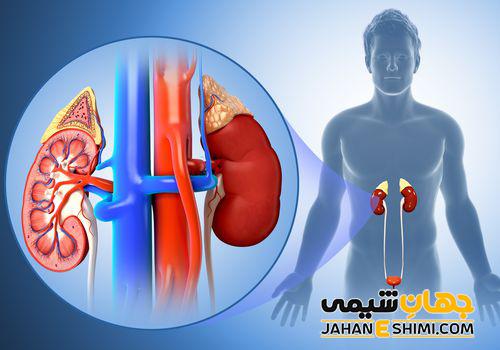 عفونت کلیه چیست و چه عوارض خطرناکی دارد؟