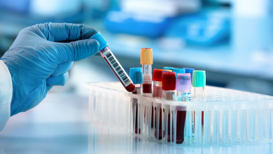 علوم آزمایشگاهی یکی از رشته هایی است که در بین افرادی که می خواهند وارد دانشگاه شده و ادامه تحصیل بدهند بسیار پرطرفدار است.