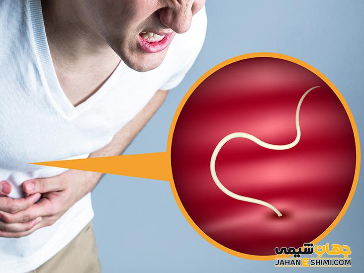 کرم آسکاریس چیست و چگونه می توان از آن پیشگیری کرد؟