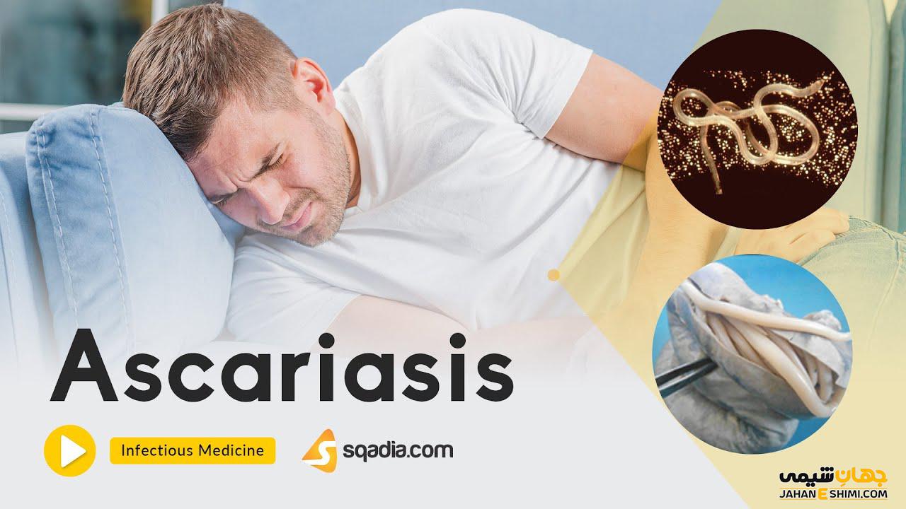 کرم آسکاریس چیست و چگونه می توان از آن پیشگیری کرد؟