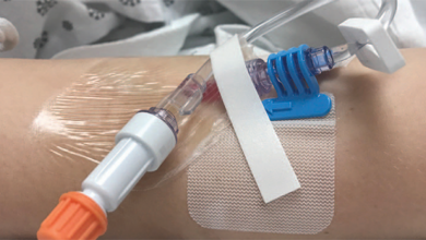 از انواع آنژیوکت و کاربردهای آن چه می دانید؟