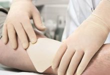 پانسمان آلژینات چیست؟ کاربرد و مزیت ژل آلژینات در بهبود زخم