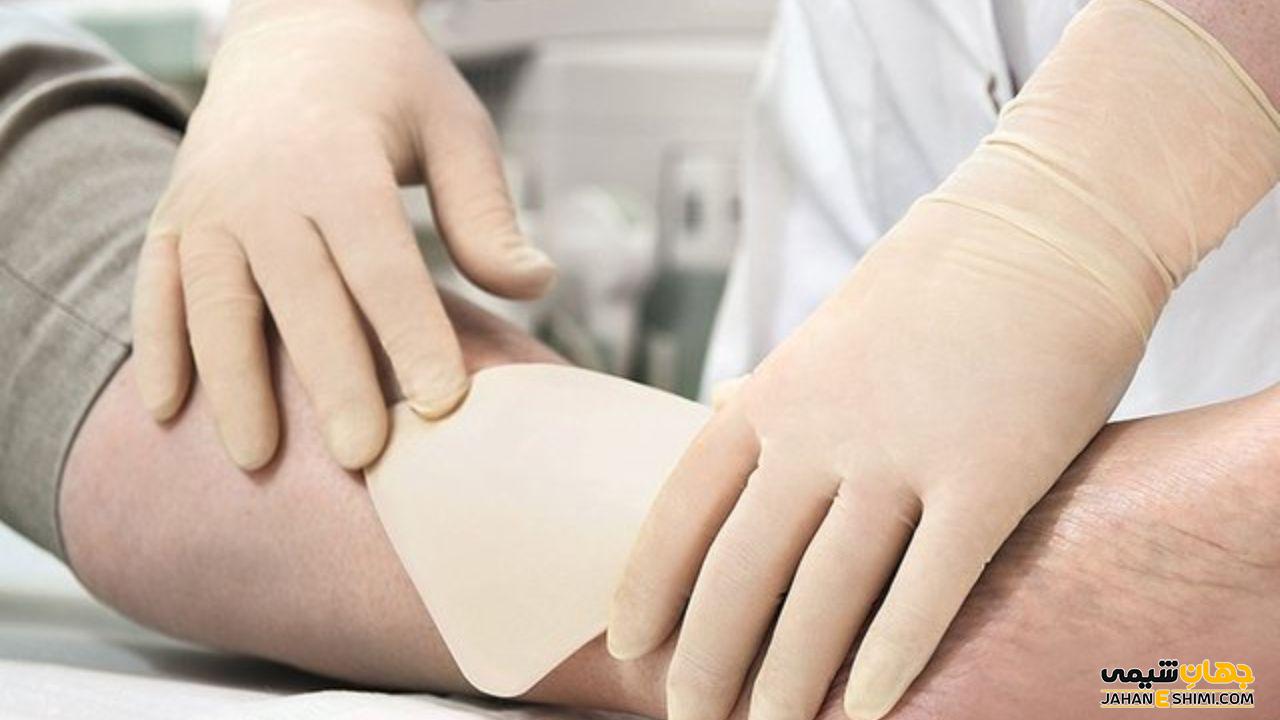 پانسمان آلژینات چیست؟ کاربرد و مزیت ژل آلژینات در بهبود زخم
