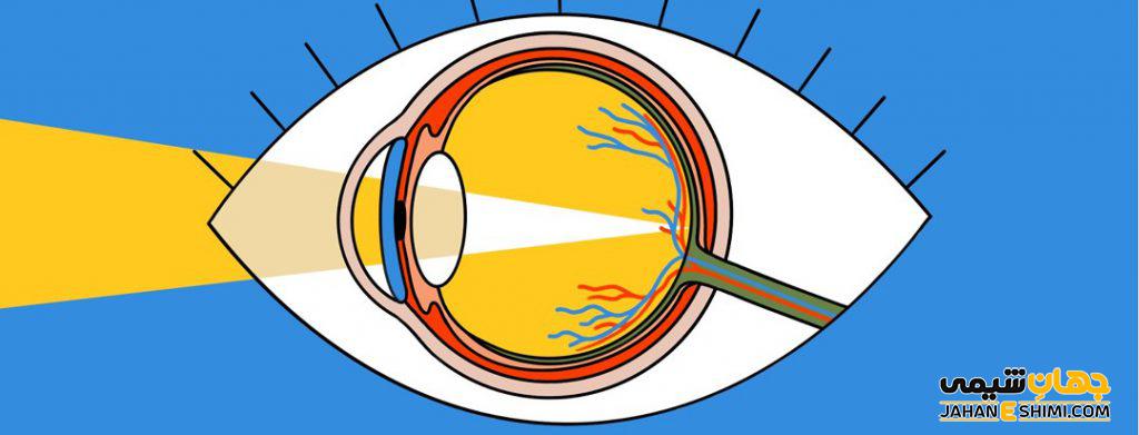 نزدیک بینی و دوربینی چیست و چگونه درمان میشود؟