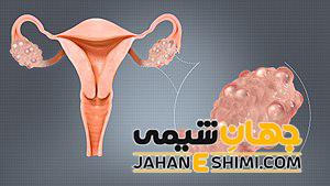 تخمدان