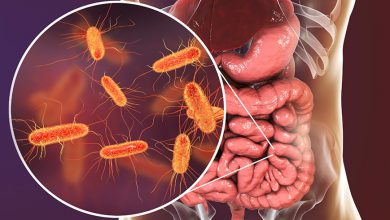 باکتری ای کولای (E. coli) چیست: روش های تشخیص و درمان آن کدام است؟