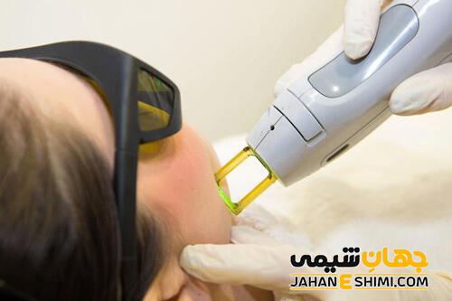 مزایا و معایب دستگاه لیزر الکساندرایت - قیمت و عوارض