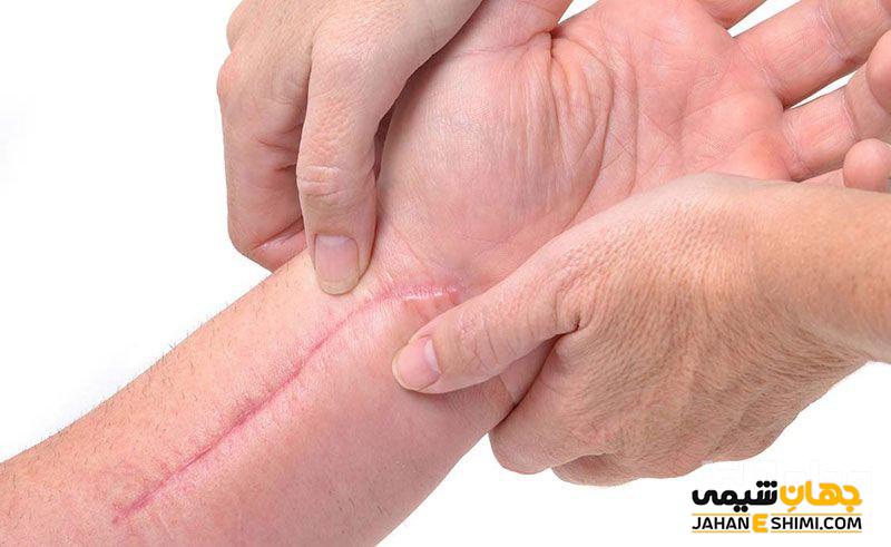 کرم اسکار رژودرم: بهترین ترمیم کننده پوست