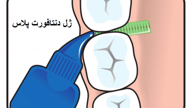 کاربرد و فواید ژل مسکن دندان درد دنتافورت پلاس