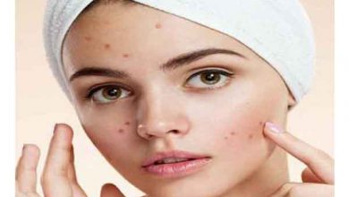 عرق گیاهی برای جوش صورت