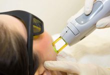 دستگاه لیزر دایود چیست؟