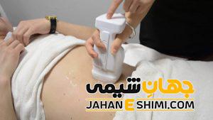 استفاده از لیزر هایفو برای لاغری