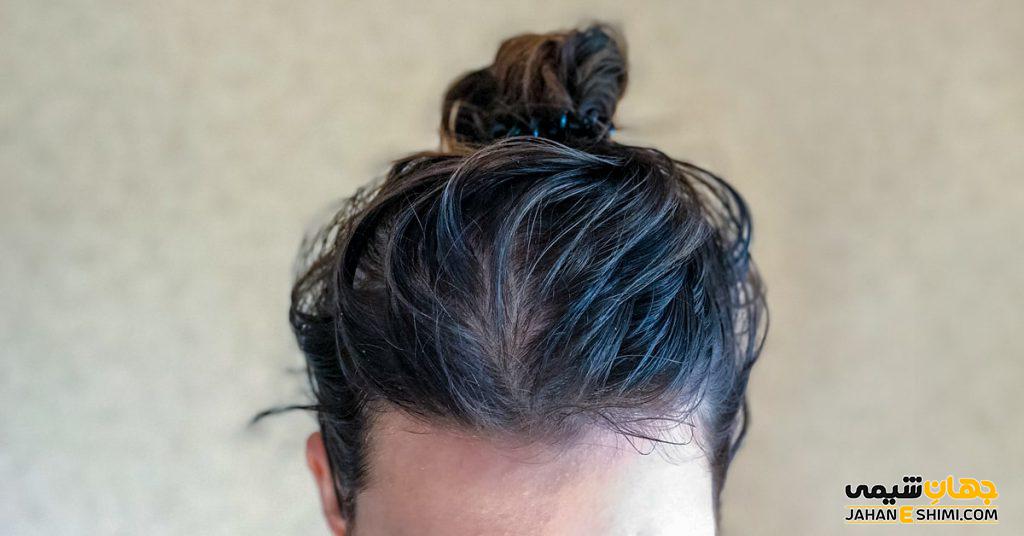 شامپو مناسب برای کنترل چربی پوست و مو چیست؟