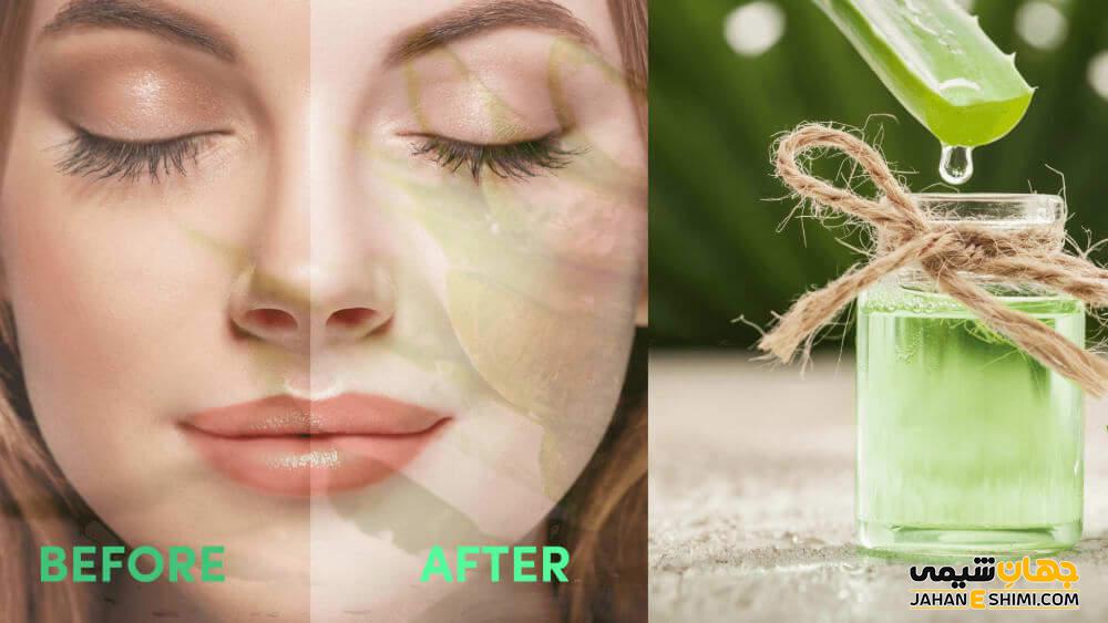 طریقه مصرف آلوئه ورا برای پوست