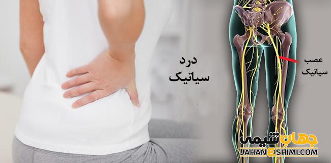 عرق النسا چیست؟ معرفی راه درمان آن