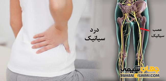 عرق النسا چیست؟ معرفی راه درمان آن 