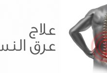 پماد عرق النسا