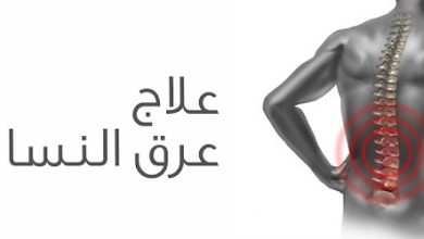 پماد عرق النسا