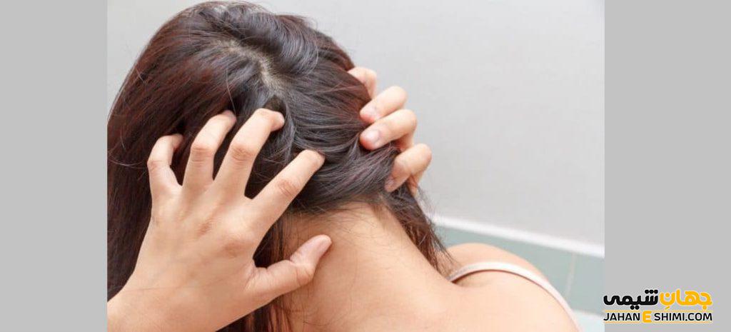 شامپو مناسب برای کنترل چربی پوست و مو چیست؟