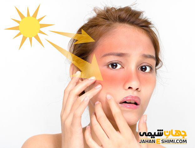 محافظت از پوست در برابر نور خورشید