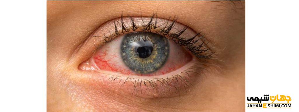 قطره استریل چشمی فلوکورت چیست؟ موارد مصرف و عوارض جانبی آن
